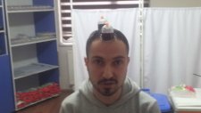 HACAMATLA ŞİFA BULANLAR-1