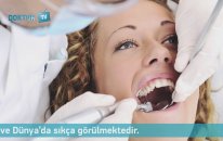 Diş Çürükleri Nasıl Oluşur?
