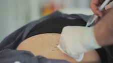 Proloterapi Tedavisinin Etkileri Kalıcı Mı?
