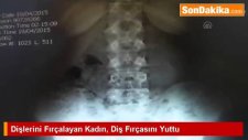Dişlerini Fırçalayan Kadın Diş Fırçasını Yuttu