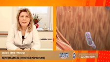 Uzm.dr.deniz Yardımcı Ergenlik Sivilcesi (Akne) Nedir? Nasıl Tedavi Edilir?