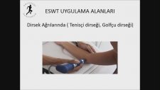 ESWT Uygulaması ( Şok Dalga Tedavisi )