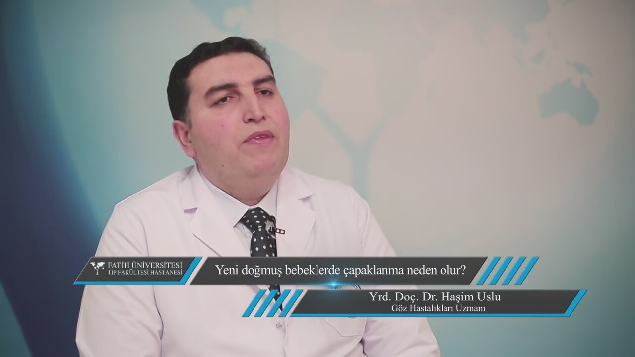 Bebeklerde göz çapaklanması Bebeklerde göz çapaklanması