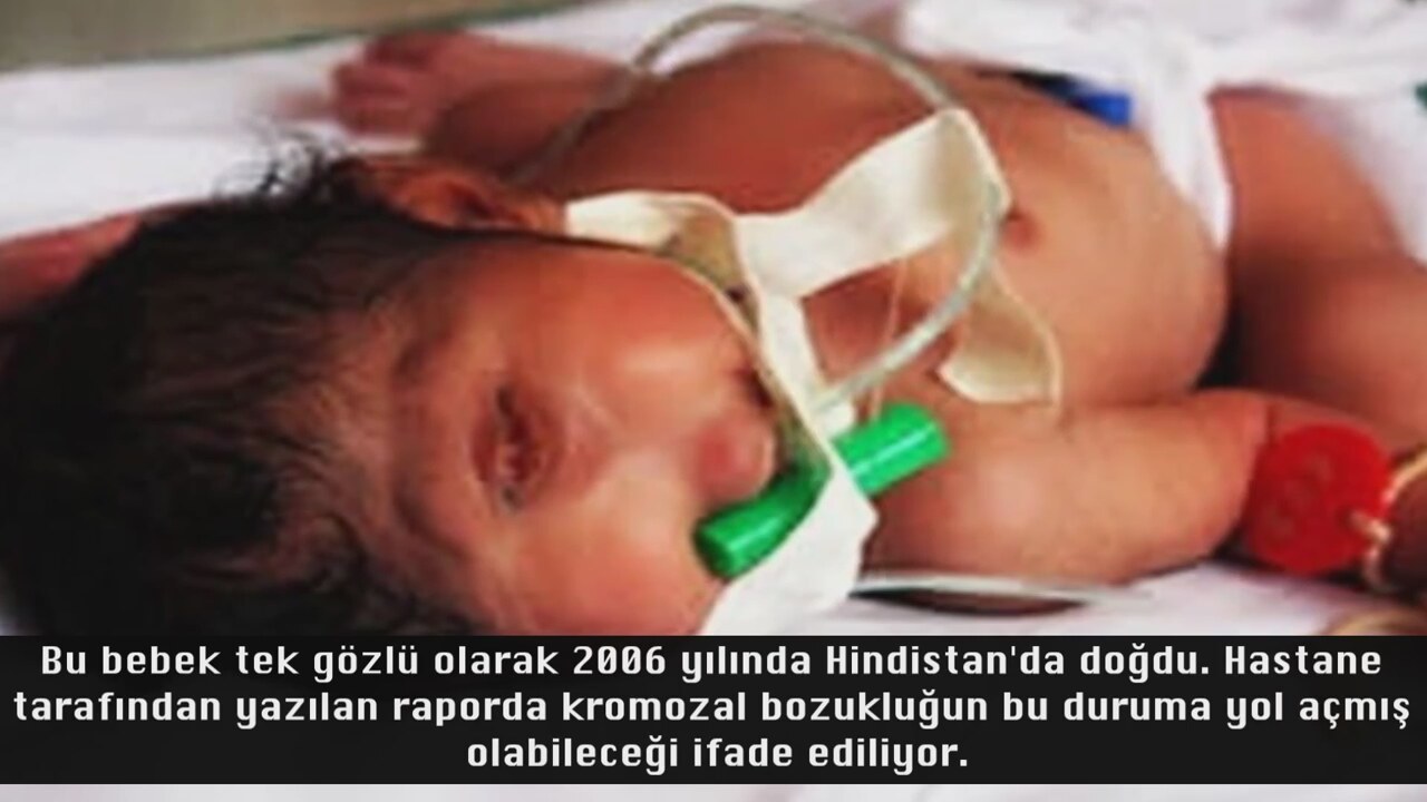 Dünyaya göre, dünyadaki en sıradışı çocuk Dünyaya göre, dünyadaki en sıradışı çocuk