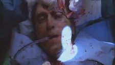 Nip/tuck - Silvio'nun Yüz Ameliyatı