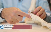 Prof. Dr. Tahir ÖĞÜT - ÇOCUKLARDA DÜZ TABANLIK NEDİR ?