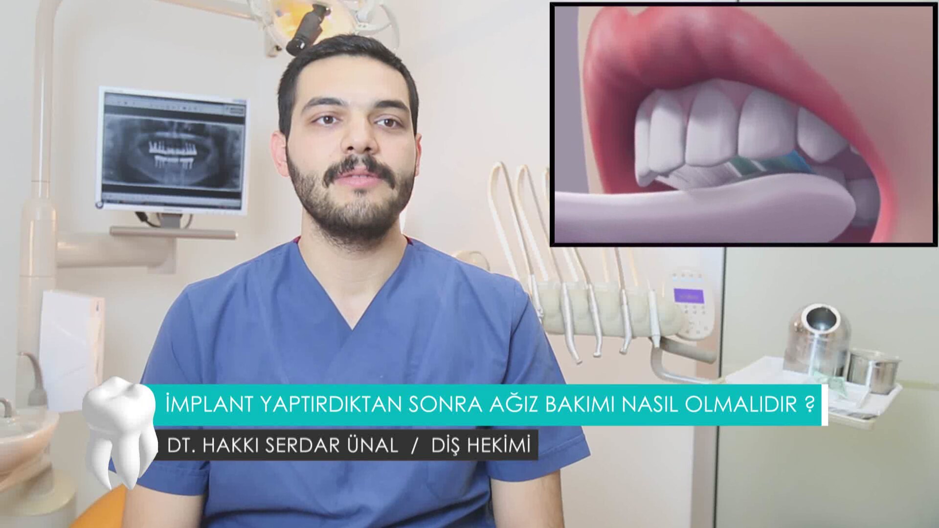 Diş Bakımı Nasıl Olmalı Diş Bakımı Nasıl Olmalı