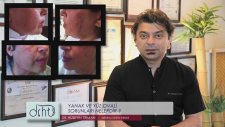 Yanak ve yüz ovali sorunları nelerdir? - Dr. Hüseyin Tırman