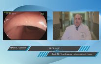 ERCP nedir ?