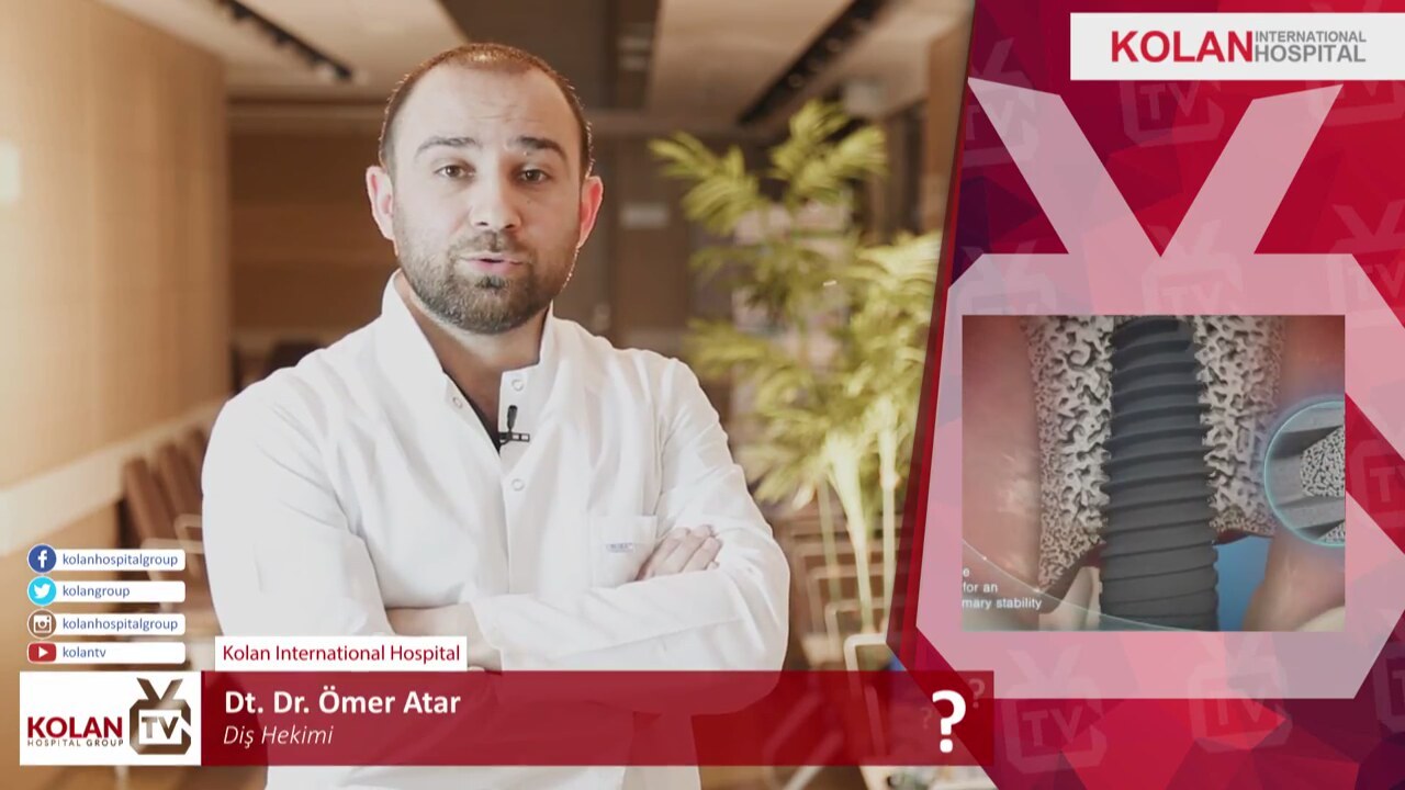 Avantajları Ve Dezavantajları Nelerdir Avantajları Ve Dezavantajları Nelerdir
