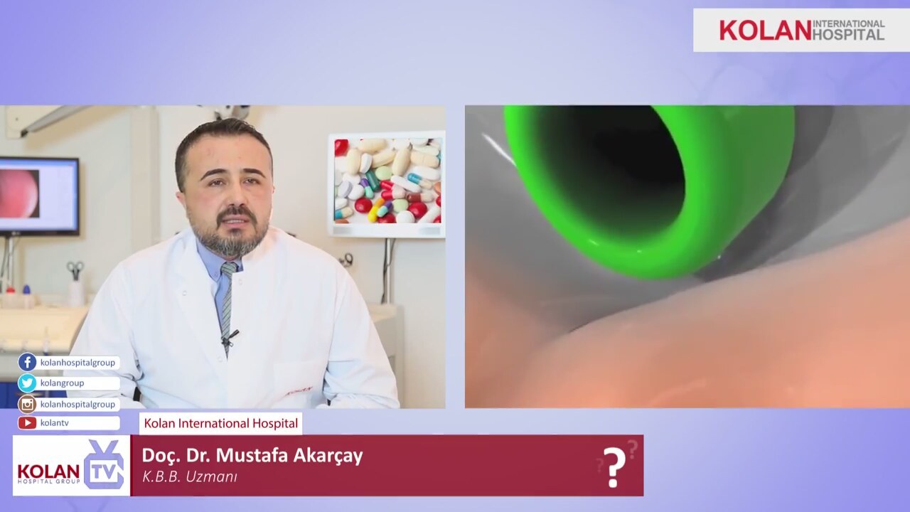 Kulak tıkanıklığının güvenli tedavisi Kulak tıkanıklığının güvenli tedavisi