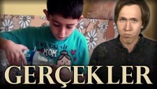 Deney Yapan Çocuğun Gerçek Hikayesi