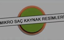 Mikro Saç Kaynak Resimleri