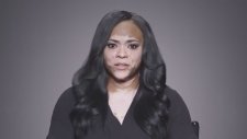 Michael Jackson'ın hastalığı - Vitiligo