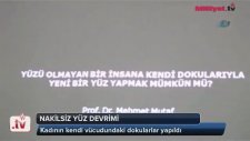 Kendi Vücut Dokularından Yüz Nakli Yapılan Kadın