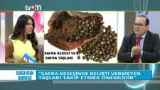 Safra kesesi taşı nasıl oluşur