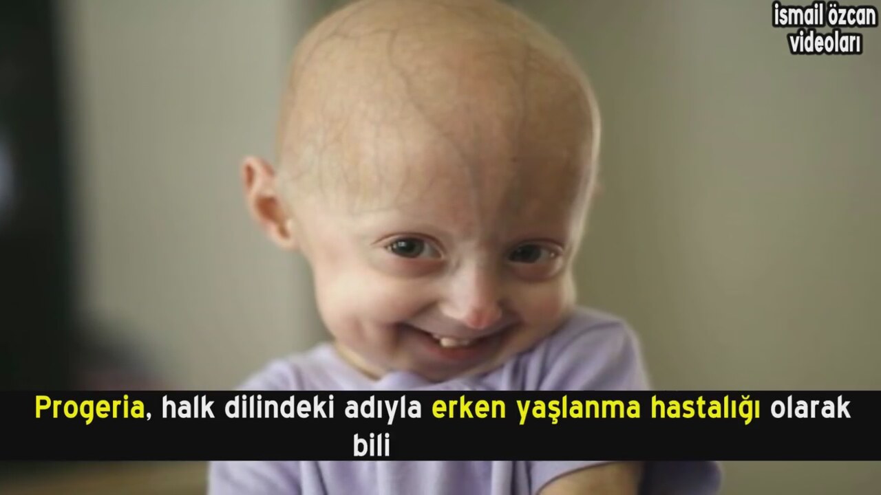 Dünyaya göre, dünyadaki en sıradışı çocuk Dünyaya göre, dünyadaki en sıradışı çocuk