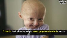 Genetik Bozukluk ile Dünyaya Gelmiş 10 Bebek
