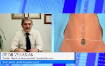 Op. Dr. Veli Aslan - Karın Germe (Abdominoplasti)