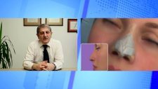 Op. Dr. Veli Aslan - Rinoplasti Nedir?