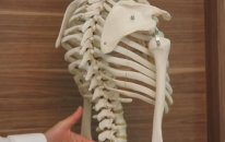 Ergen kifozu nedir? - DOÇ. DR. MEHMET AYDOĞAN