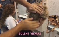 Mikro Saç Kaynağı Nasıl Yapılır? Öncesi Sonrası Resimleri