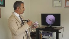 Endoskopik Sinüs Cerrahisi Nedir?