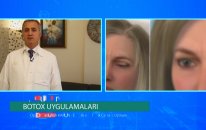 Op. Dr. Sadullah Karun - Botox Uygulamaları