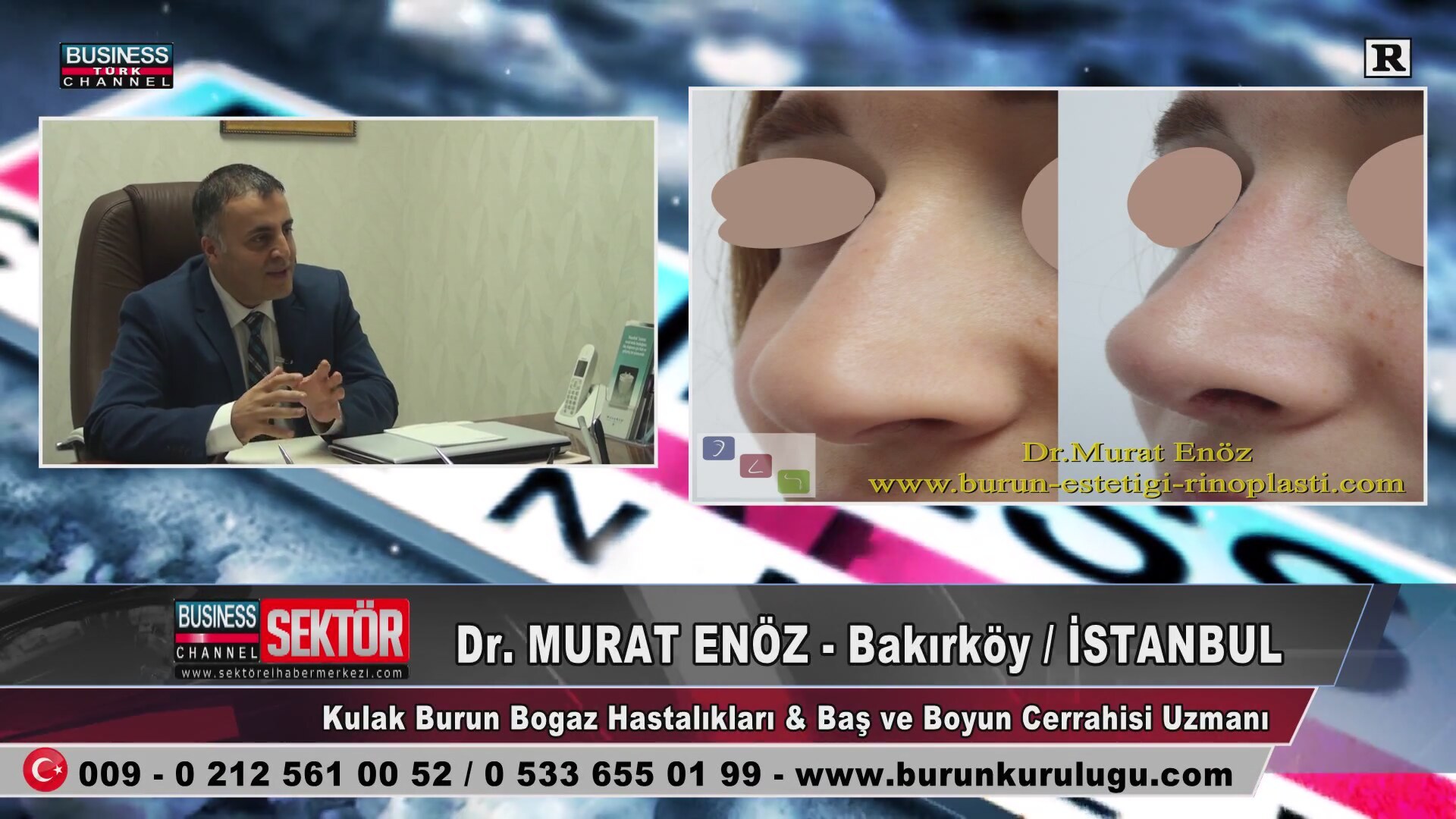 Burun Estetik Uzmanları İstanbul Burun Estetik Uzmanları İstanbul