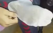 Artislik Yapcam Diye Ayağını Yakan Liseli