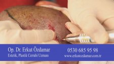 Saç ekiminde kök hücre tedavisi ne aşamada?