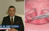Bademcik - Prof. Dr. Ahmet ÖZDOĞAN