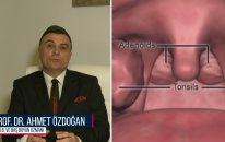 Geniz eti - Prof. Dr. Ahmet Özdoğan