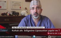 Koltuk Altı Bölgesine Liposuction Yapılır mı ?