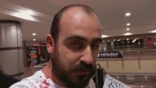 Kamera Şakası Yapayım Derken Kafayı Yarmak (Samimiyetsizlik İçerir)