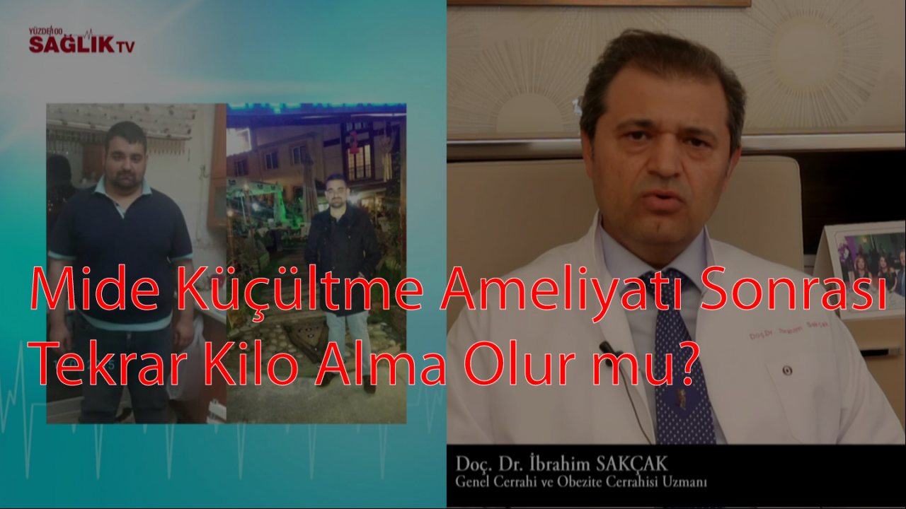 Ameliyatlı Mide Küçültme Yolları Yöntemleri Ameliyatlı Mide Küçültme Yolları Yöntemleri