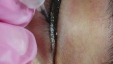 Kalıcı Makyaj Eyeliner Tekniği
