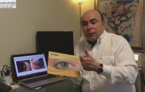 Gözde Et (Pterjium) Nedir?gözde Et Tedavisi Nasıl Yapılır - Sağlık