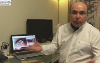 Gözün beyazında kanama | Göz doktorunuz yanıtlıyor.