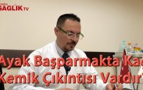 Op. Dr. Altuğ Tanrıöver - Ayak Başparmakta Kaç Tip Kemik Çıkıntısı Bulunur ?