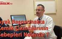 Op. Dr. Altuğ Tanrıöver - Ayak Başparmakta Kemik Çıkıntılarının Sebepleri