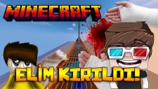ELİM KIRILDI! - Minecraft Elmas Parkur!
