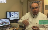 Astigmat Nedir? Astigmat Tedavisi Nasıl Yapılır? - Sağlık