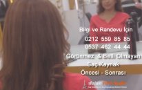Görünmez Saç Kaynak Videosu - Saç Kaynak Öncesi - Sonrası - Sac Kaynak Merkezi