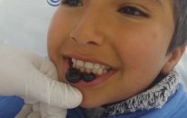 Çocuklara Sülük.... Ağız Ve Diş Sağlığı İçin Van Hacamat Ve Sülük Tedavi Merkezi