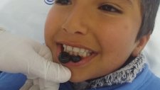 Çocuklara Sülük.... Ağız Ve Diş Sağlığı İçin Van Hacamat Ve Sülük Tedavi Merkezi