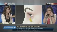 Op. Dr. Sultan Kaya Ünsal - Göz Kapağı Estetiği Nasıl Yapılır?