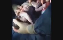 Keseyle Birlikte Doğan Bebeğin Keseden Çıkış Anı Dikkatli İzleyin