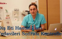 Diş Eti Hastalıkları Tedavileri Sonrası Kontroller - Prof Dr Bülent Kurtiş - Sağlık