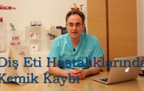 Diş Eti Hastalıklarında Kemik Kaybı - Prof Dr Bülent Kurtiş - Sağlık